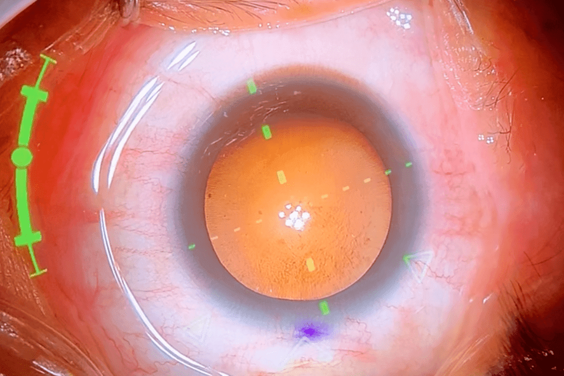 デジタル処理のイメージ