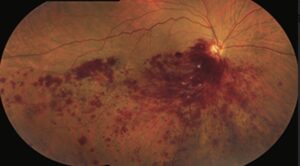 今年最後の緊急手術